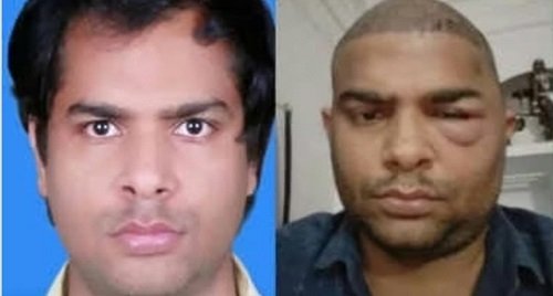 Kanpur: Another engineer dies in the desire of having thick hair, same doctor accused again