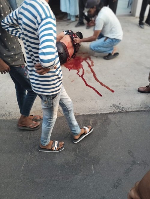 Bullets echoed again in the capital: Young man shot in the chest in Ghazipur, admitted to Lohia Hospital