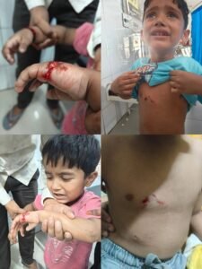 Lucknow: Terror of stray dogs in the capital, people are suffering due to the negligence of the Municipal Corporation