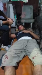 16-year-old Ratan Dubey is battling for life, the attackers are still roaming freely – The limits of brutality crossed in Tilthi village of Mirzapur