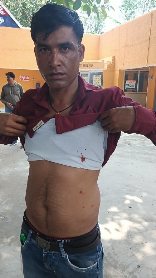 A deadly attack on an e-rickshaw driver on the side of Shaheed Path