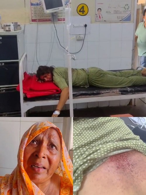 In Aligarh's Gomat village, the younger brother shot the elder sister in the back while she was cooking food. The sister got injured due to the bullet shot and was referred for medical treatment.