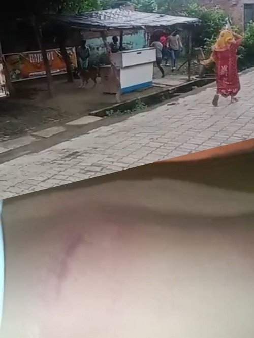 Lucknow: Protesting against molestation of niece proved costly, goons entered the house and beat up the family