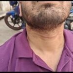 Lucknow: Chinese magha continues to wreak havoc in the capital, Lucknow.