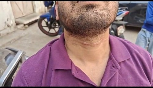 Lucknow: Chinese magha continues to wreak havoc in the capital, Lucknow.