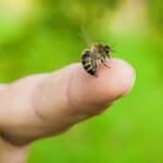 Do Not Take a Bee Sting Lightly: Doctor Outlines Essential Prevention and Treatment Measures
