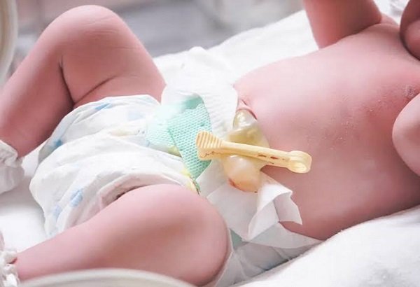 What is done with a newborn's umbilical cord? Learn about the traditions, scientific facts, and essential precautions.