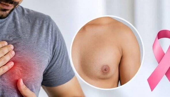 Men can also develop breast cancer; do not ignore symptoms such as a lump in the nipple and discharge.