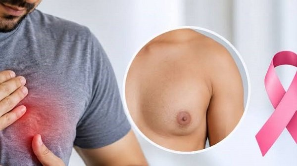 Men can also develop breast cancer; do not ignore symptoms such as a lump in the nipple and discharge.
